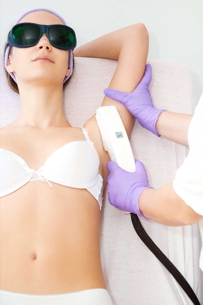 Does Laser Hair Removal Works?