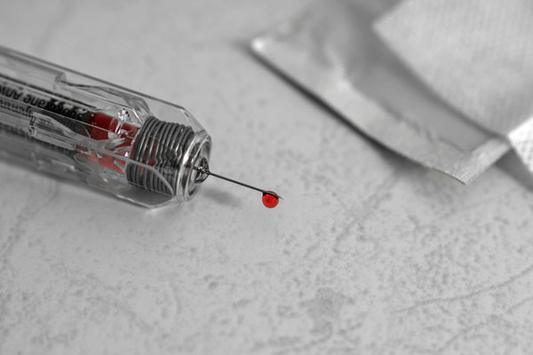 Does PRP work, or is it too good to be true?