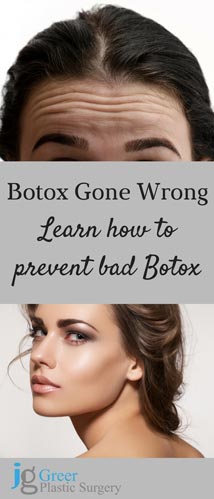 Botox Gone Wrong