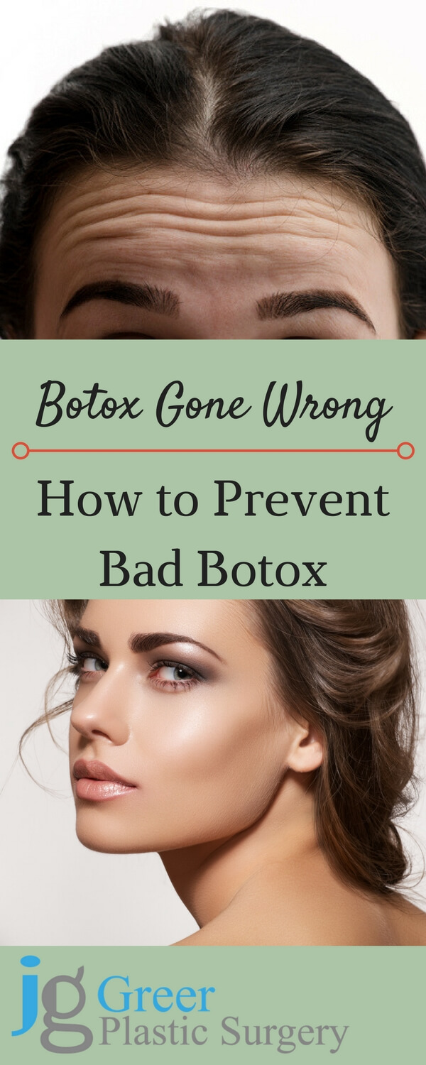 botox gone wrong