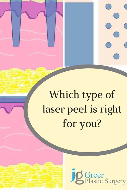 Type of Laser Peel