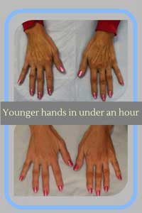 younger hands bbl