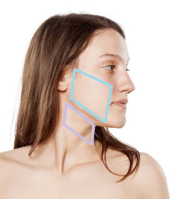 face lift and neck lift locations