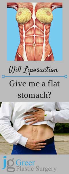 will liposuction give me a flat stomach - diagram of abdominal muscles and woman's stomach showing rectus diastasis