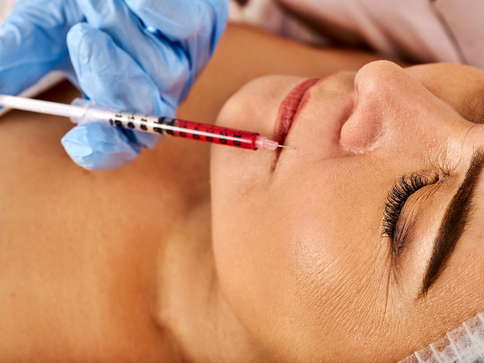 What Are Fillers? How to Choose the Right Filler?
