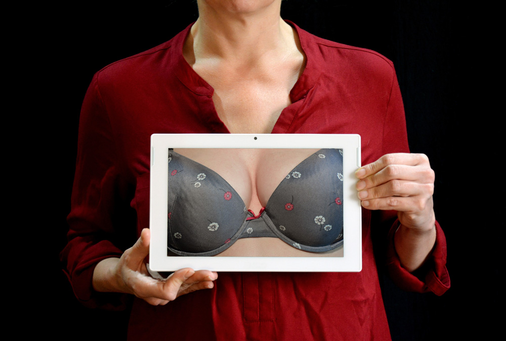mentor breast reduction surgery
