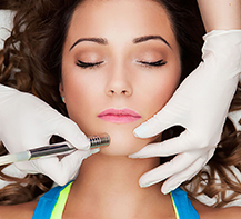Dermasweep Dermasweep Procedure in Mentor, OH