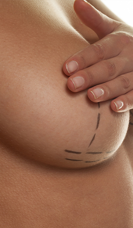 Breast Surgeries - Greer Plastic Surgery