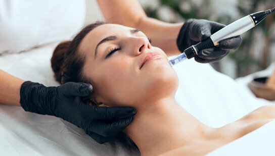 Vivace RF Microneedling Treatment