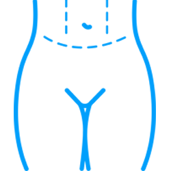 Abdominioplasty Icon