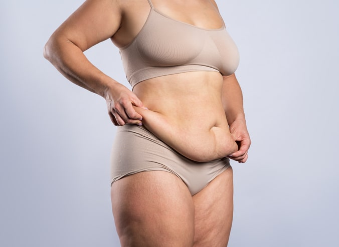 Liposuction in Mentor, Ohio