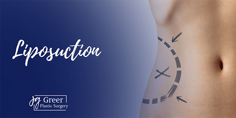 Life Changing Liposuction at Greer Plastic Surgery